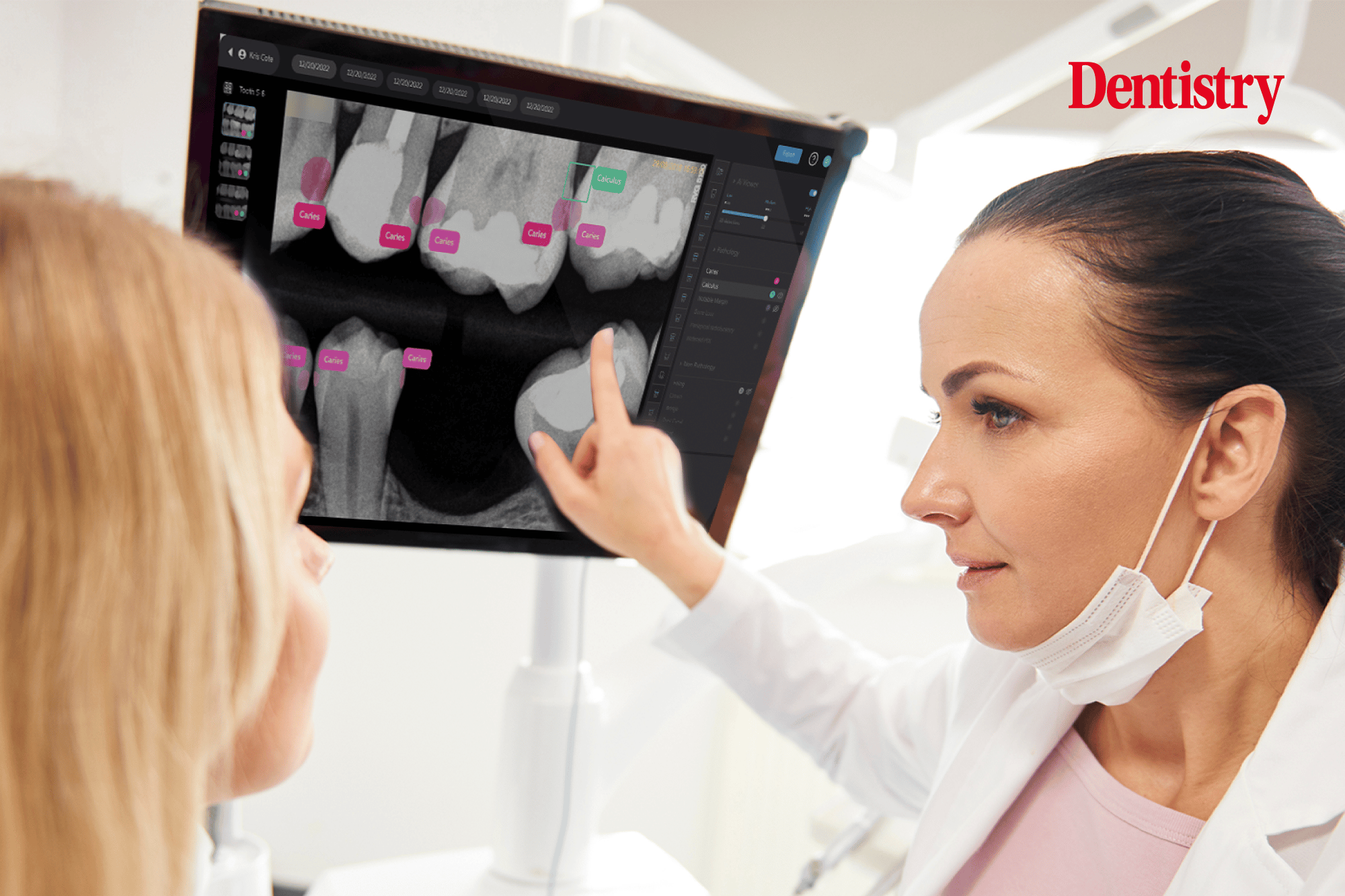 Dental imaging technology showing AI overlay analysis