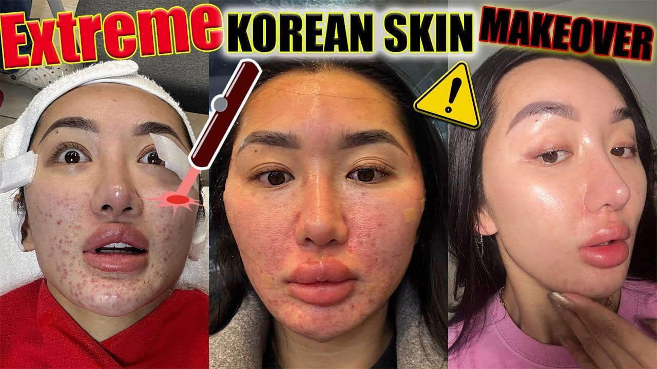 Korean dermatologist performing laser toning facial treatment on patient in modern Seoul clinic