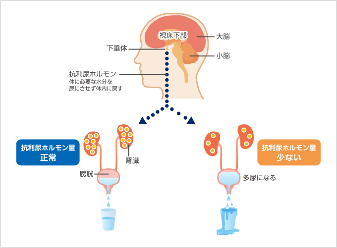 中途覚醒の原因と対策 - Genspark